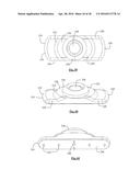 Total Disc Replacement System and Related Methods diagram and image