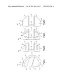 Intervertebral Implant with Blades for Connecting to Adjacent Vertebral     Bodies diagram and image