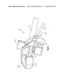 Intervertebral Implant with Blades for Connecting to Adjacent Vertebral     Bodies diagram and image