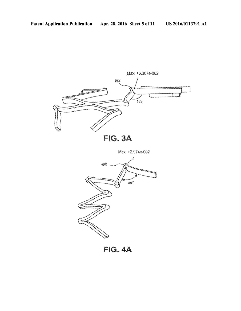 Implants Having High Fatigue Resistance, Implant Delivery Systems, and     Methods of Use - diagram, schematic, and image 06