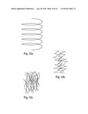 ABSORBENT ARTICLE WITH CORE-TO-BACKSHEET GLUE PATTERN COMPRISING TWO GLUES diagram and image