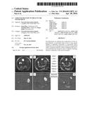 TARGETED DELIVERY OF DRUGS TO THE MYOMETRIUM diagram and image