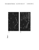 TARGETED DELIVERY OF DRUGS TO THE MYOMETRIUM diagram and image