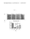 METHODS AND SYSTEMS OF TREATING WOUNDS diagram and image