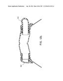 NASAL ASSEMBLY diagram and image