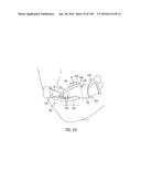 NASAL ASSEMBLY diagram and image