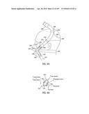 NASAL ASSEMBLY diagram and image