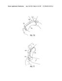 NASAL ASSEMBLY diagram and image