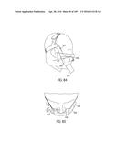 NASAL ASSEMBLY diagram and image