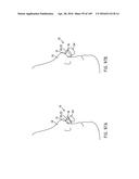 NASAL ASSEMBLY diagram and image