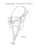 NASAL ASSEMBLY diagram and image