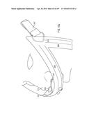 NASAL ASSEMBLY diagram and image