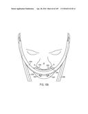 NASAL ASSEMBLY diagram and image