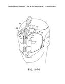 NASAL ASSEMBLY diagram and image