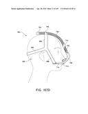 NASAL ASSEMBLY diagram and image