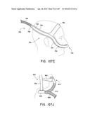 NASAL ASSEMBLY diagram and image