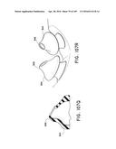 NASAL ASSEMBLY diagram and image