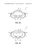 PATIENT INTERFACE DEVICES WITH ADHESIVE ATTACHNMENT diagram and image