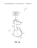 PATIENT INTERFACE DEVICES WITH ADHESIVE ATTACHNMENT diagram and image