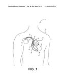 MEDICAL ELECTRICAL LEAD diagram and image