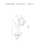 CONTACT LENS FOR INCREASING TEAR PRODUCTION diagram and image