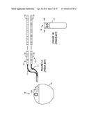 EXTERNAL TRIAL STIMULATOR USEABLE IN AN IMPLANTABLE NEUROSTIMULATOR SYSTEM diagram and image