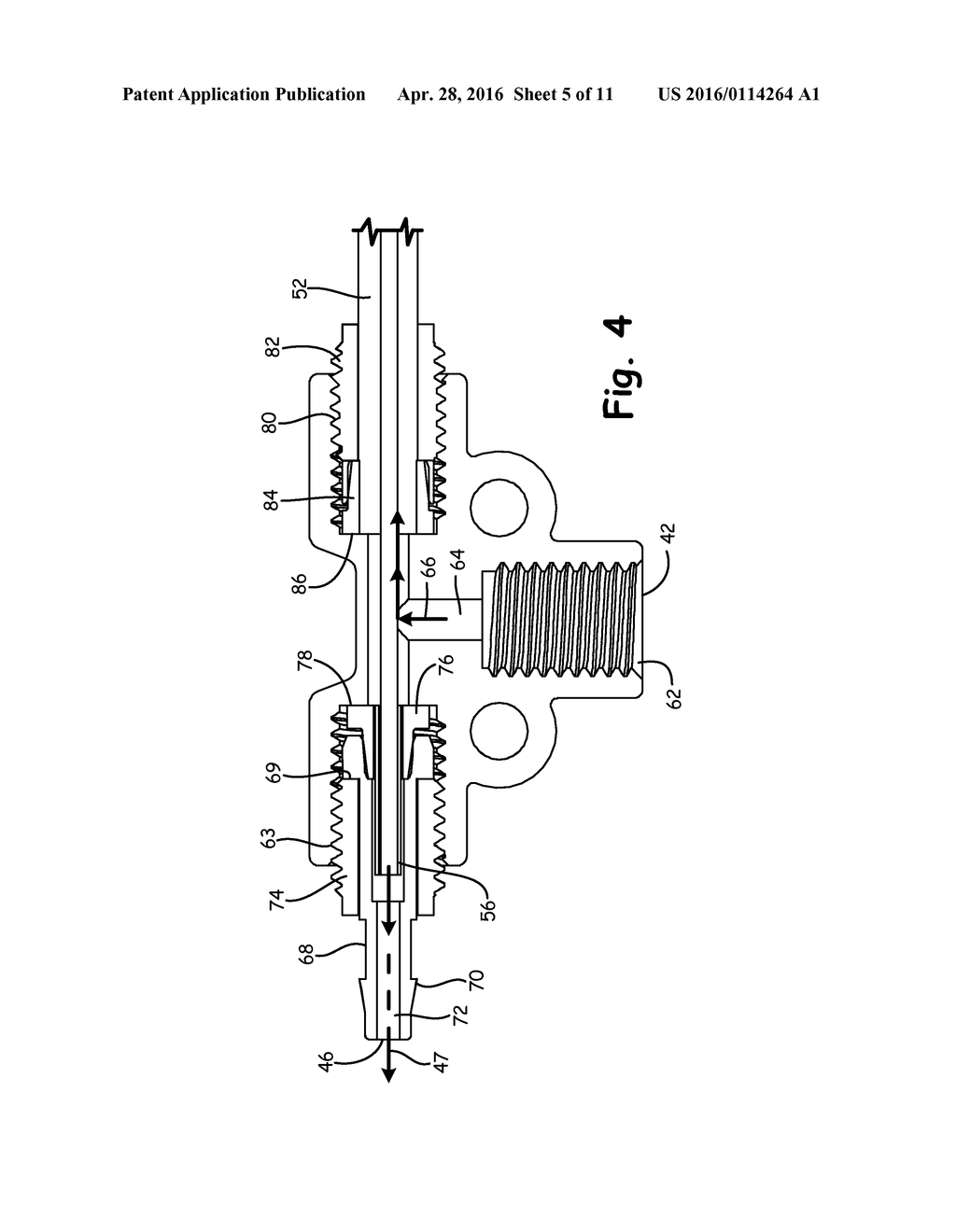 Axial Transfer Line Shell Side Degassing - diagram, schematic, and image 06