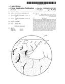 ANTI-SLIP COVERINGS FOR SURFACES diagram and image