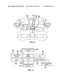 Electronic Display Device diagram and image