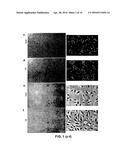 ISOLATION, EXPANSION AND USE OF CLONOGENIC ENDOTHELIAL PROGENITOR CELLS diagram and image