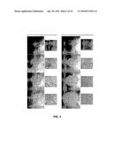 ISOLATION, EXPANSION AND USE OF CLONOGENIC ENDOTHELIAL PROGENITOR CELLS diagram and image