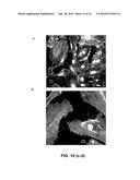 ISOLATION, EXPANSION AND USE OF CLONOGENIC ENDOTHELIAL PROGENITOR CELLS diagram and image