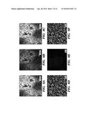 MULTI-LAYERED CELL CONSTRUCTS AND METHODS OF USE AND PRODUCTION USING     ENZYMATICALLY DEGRADABLE NATURAL POLYMERS diagram and image