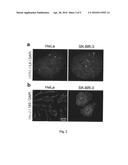 BIOMARKERS FOR DIFFERENTIATING MELANOMA FROM BENIGN NEVUS IN THE SKIN diagram and image