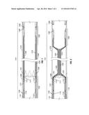 CONTROL SYSTEMS COMPRISING SUPPLEMENTARY CLOSURE DEVICES AND INWARDLY     INFLATING PACK-OFF DEVICES diagram and image