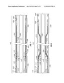 CONTROL SYSTEMS COMPRISING SUPPLEMENTARY CLOSURE DEVICES AND INWARDLY     INFLATING PACK-OFF DEVICES diagram and image