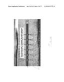 TREATMENT STRING AND METHOD OF USE THEREOF diagram and image