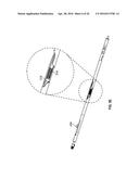 STATOR BORE GAGE diagram and image