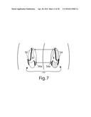 BLADELESS FLUID PROPULSION PUMP diagram and image