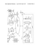 SUBCUTANEOUS OUTPATIENT MANAGEMENT diagram and image