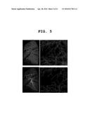 METHOD FOR DISTINGUISHING PULMONARY ARTERY AND PULMONARY VEIN, AND METHOD     FOR QUANTIFYING BLOOD VESSELS USING SAME diagram and image