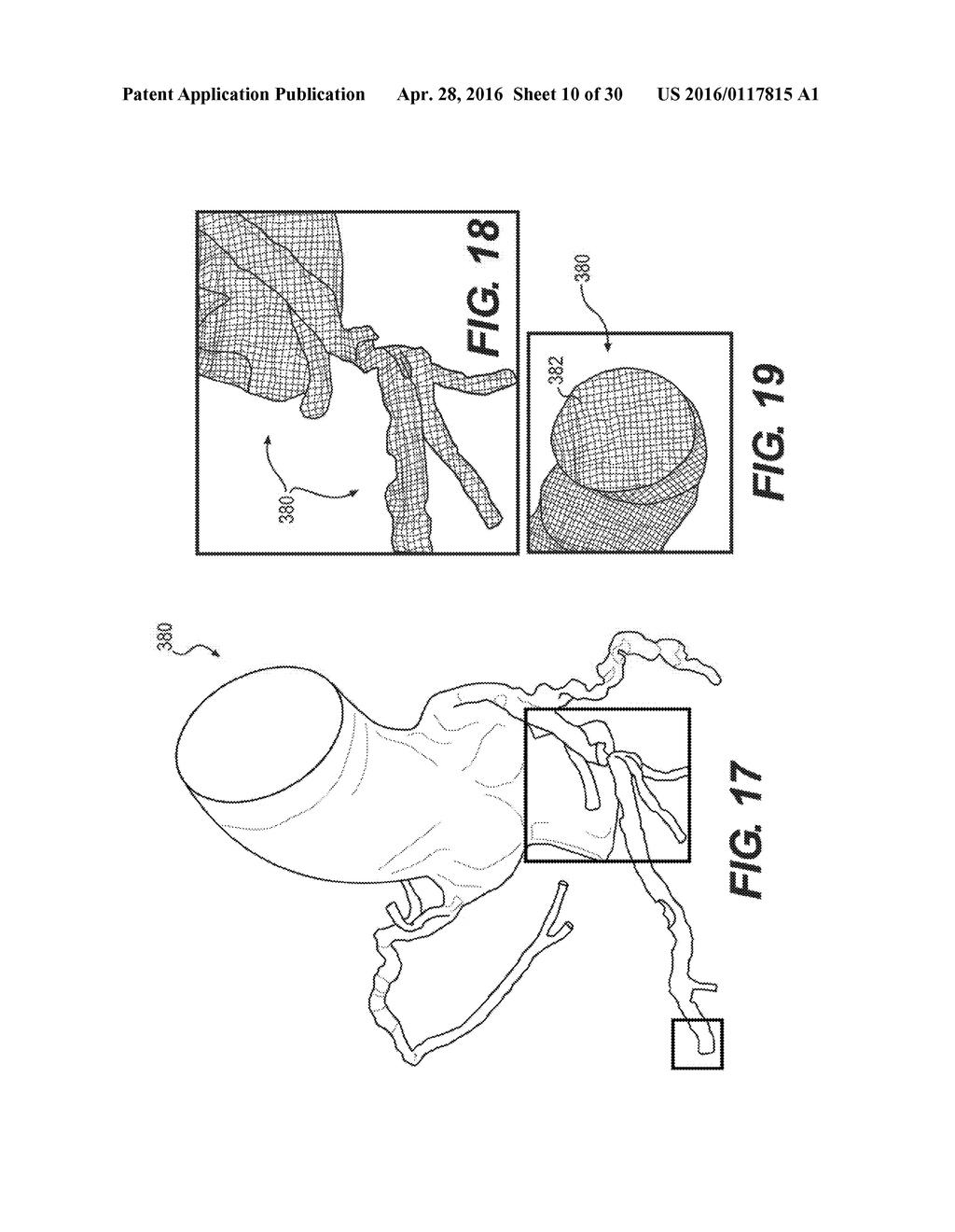 METHOD AND SYSTEM FOR IMAGE PROCESSING TO DETERMINE PATIENT-SPECIFIC BLOOD     FLOW CHARACTERISTICS - diagram, schematic, and image 11