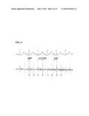 SYSTEMS FOR MONITORING THE CARDIOVASCULAR SYSTEM USING A HEART LUNG SOUND diagram and image