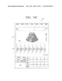 ULTRASOUND DIAGNOSIS APPARATUS AND CONTROL METHOD THEREOF diagram and image