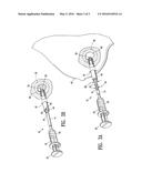 CAVITY-FILLING BIOPSY SITE MARKERS diagram and image