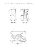 VASCULAR CLOSURE APPARATUS AND RELATED METHOD diagram and image