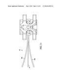 SURGICAL ACCESS SYSTEM AND RELATED METHODS diagram and image