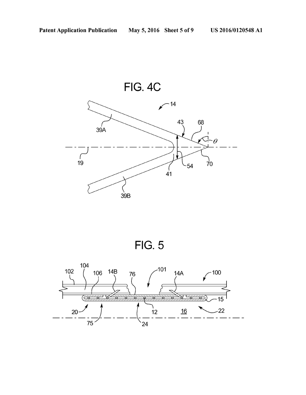 DISSOLVABLE SLEEVE CONFIGURATIONS TO AID GRAFT DEPLOYMENT - diagram, schematic, and image 06