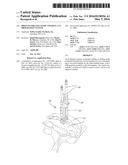 Drilling/Milling Guide and Keel Cut Preparation System diagram and image