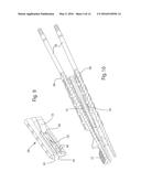 Drilling/Milling Guide and Keel Cut Preparation System diagram and image